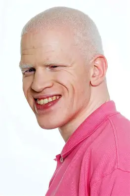 oip